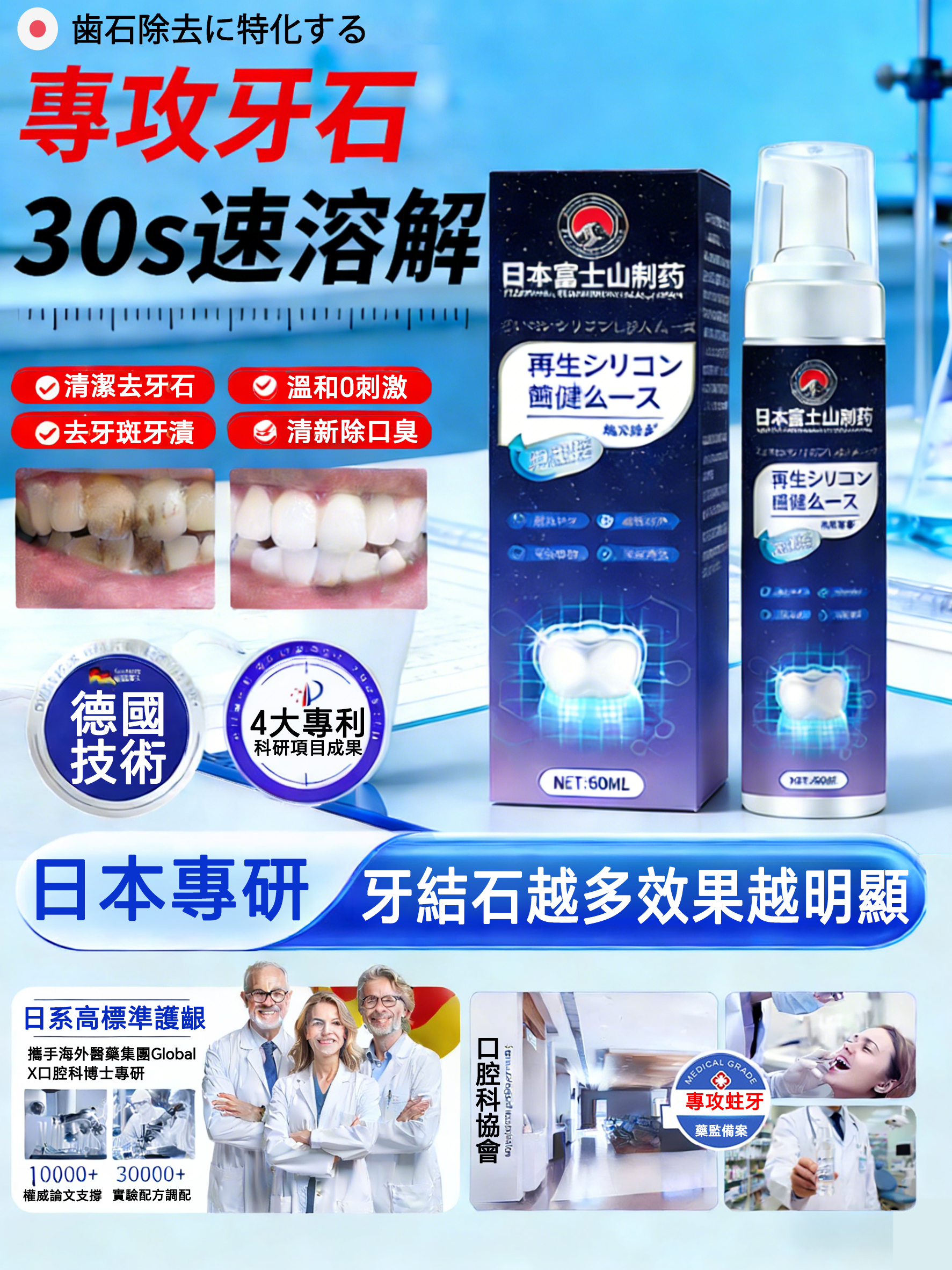 【日本專研】日本富士山製藥，潔牙健齒清潔慕斯，專攻牙石，30秒速溶解，清潔去牙石、溫和0刺激、去牙斑牙清、清新除口臭，免洗牙，德國技術、四大專利科研項目成果，攜手海外醫藥集国Global-X口腔博士專研，日系高標準護酿，牙石越多越明顯，牙黃、牙垢、牙漬強效清潔!!!